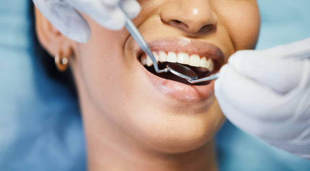 Best Emergency Denture Repair in North Olmsted, OH